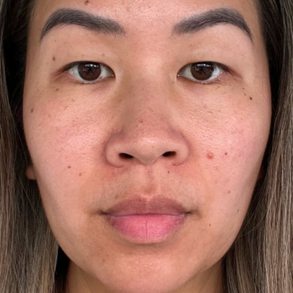 4-in-1 Radiant Renewal Skincare Wand with Red Light Therapy