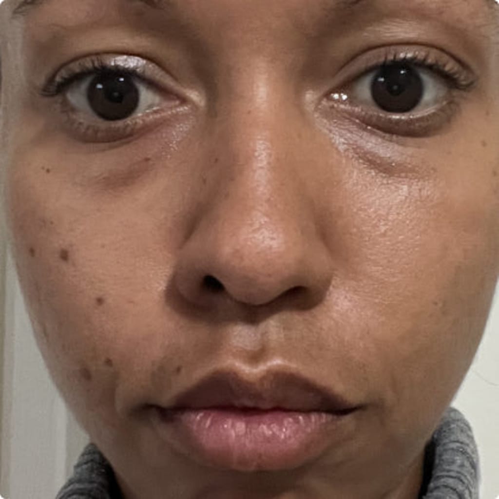 4-in-1 Radiant Renewal Skincare Wand with Red Light Therapy