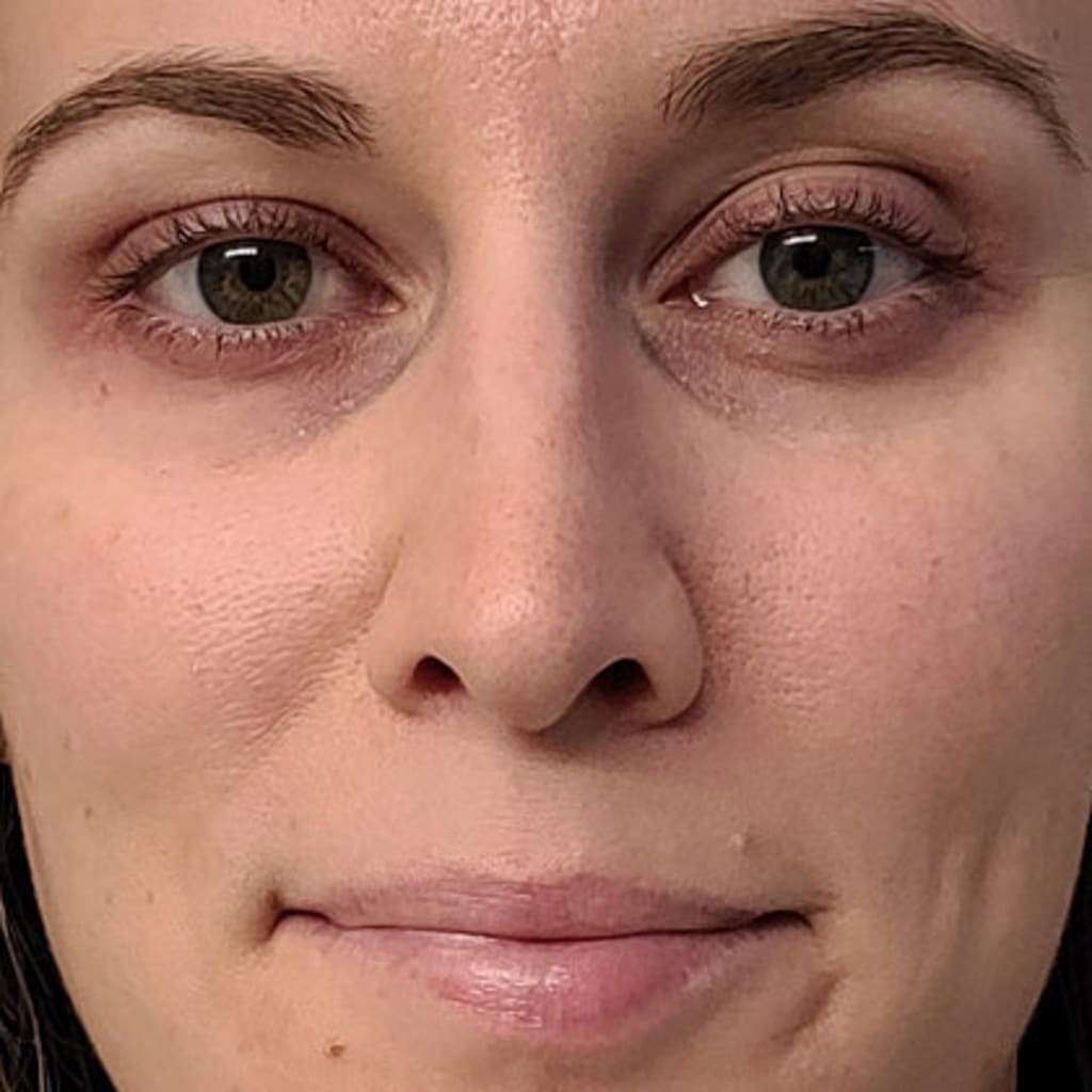 4-in-1 Radiant Renewal Skincare Wand with Red Light Therapy