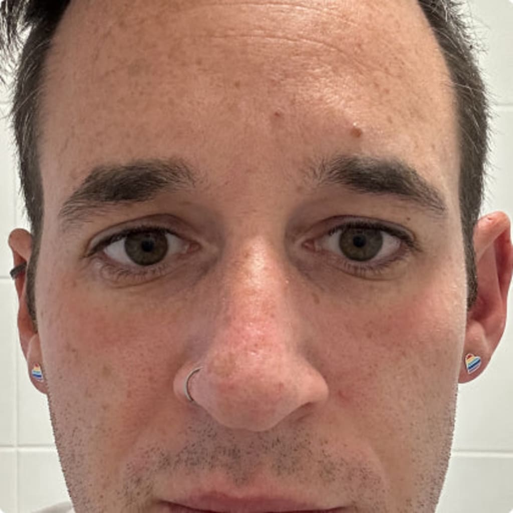 4-in-1 Radiant Renewal Skincare Wand with Red Light Therapy